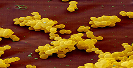 金黄色葡萄球菌